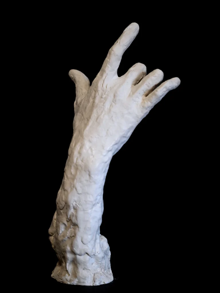 Main droite verticale, plâtre