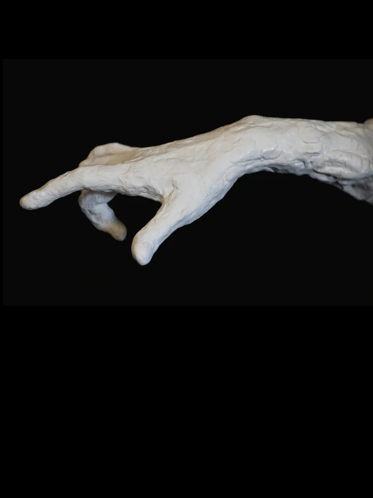 Main droite horizontale, plâtre